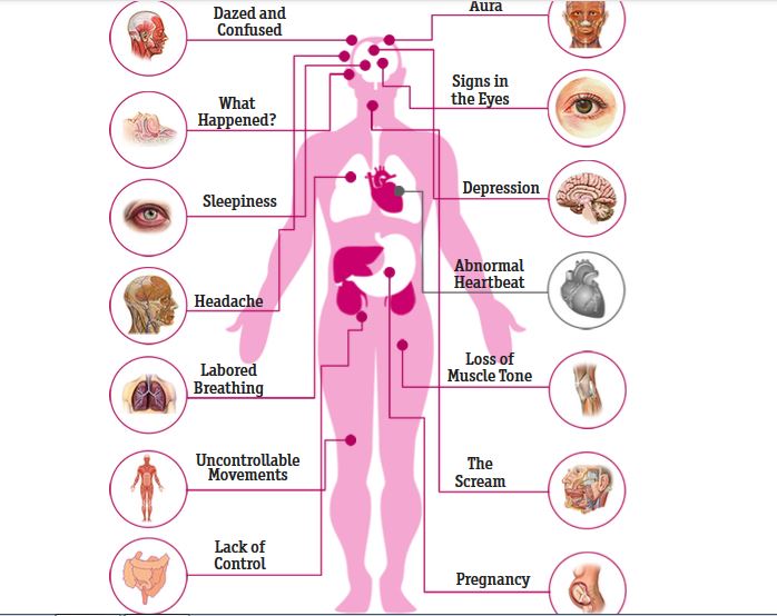 Neurological On Emaze