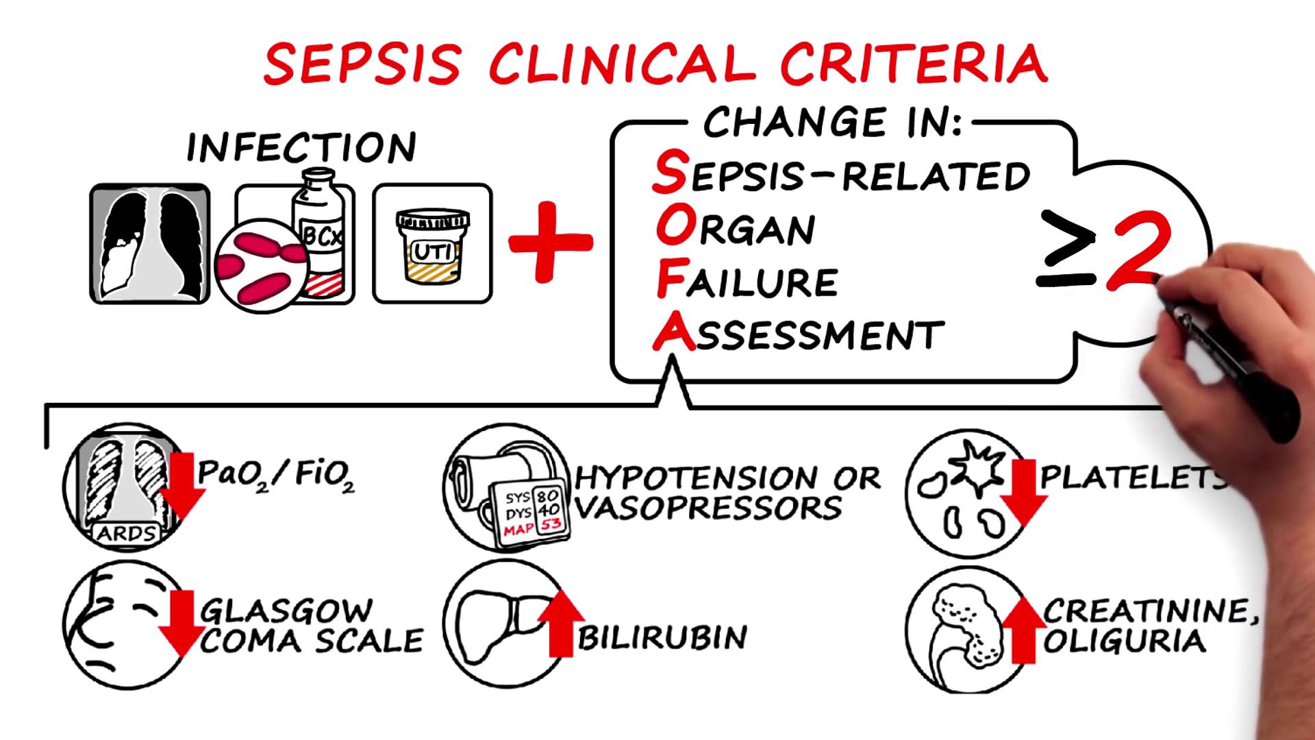 sepsis-on-emaze