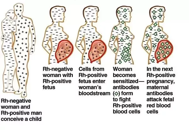 o positive mother and o negative father pregnancy