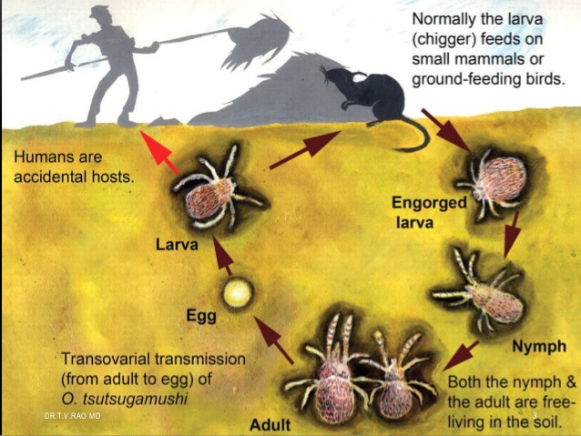 Typhus Epidemic At Emaze Presentation