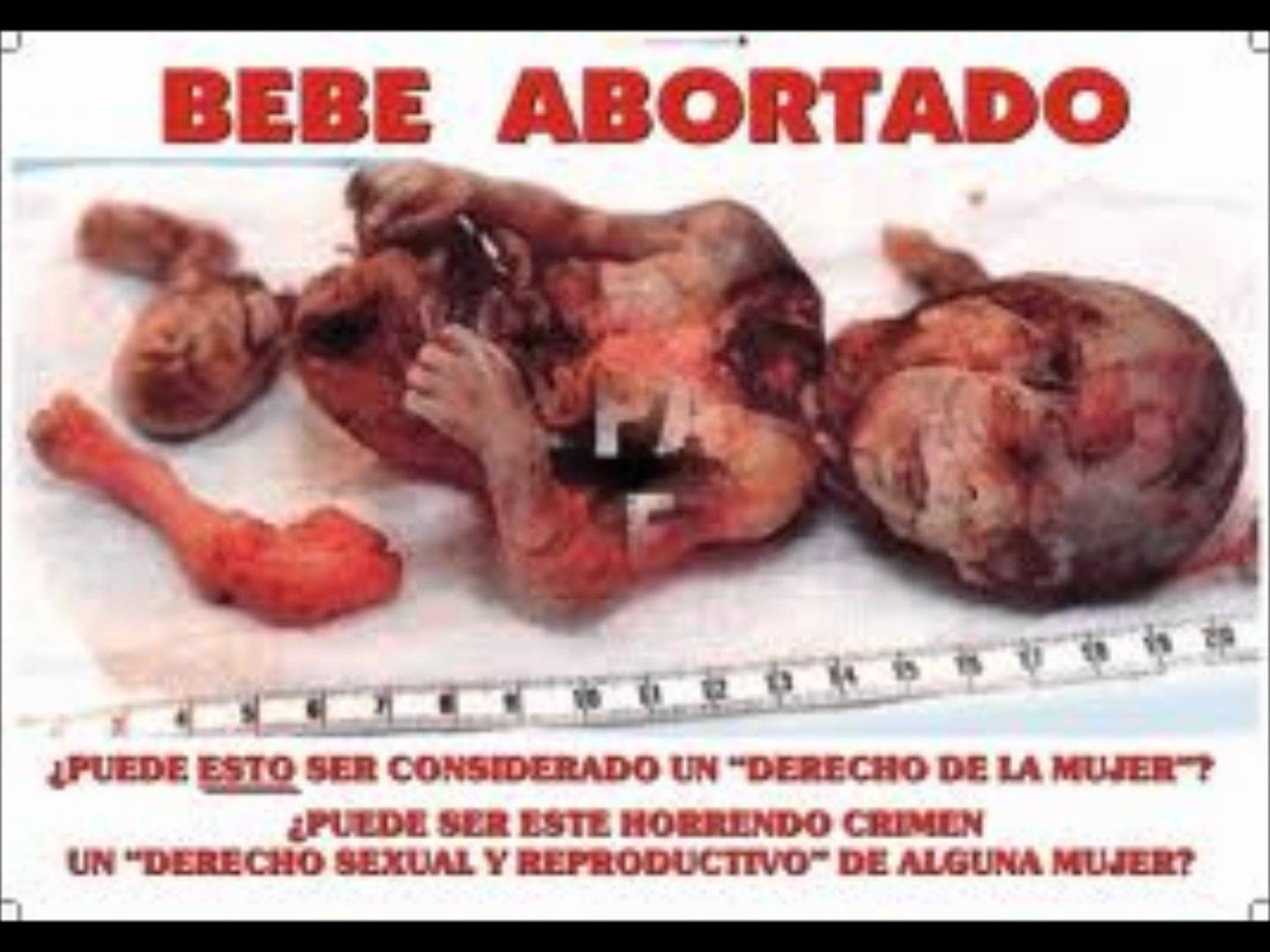 Aborto By Mayerlyvargasmonroy1 On Emaze