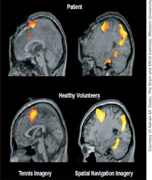 Brain Dual Processing Module 13 at emaze Presentation