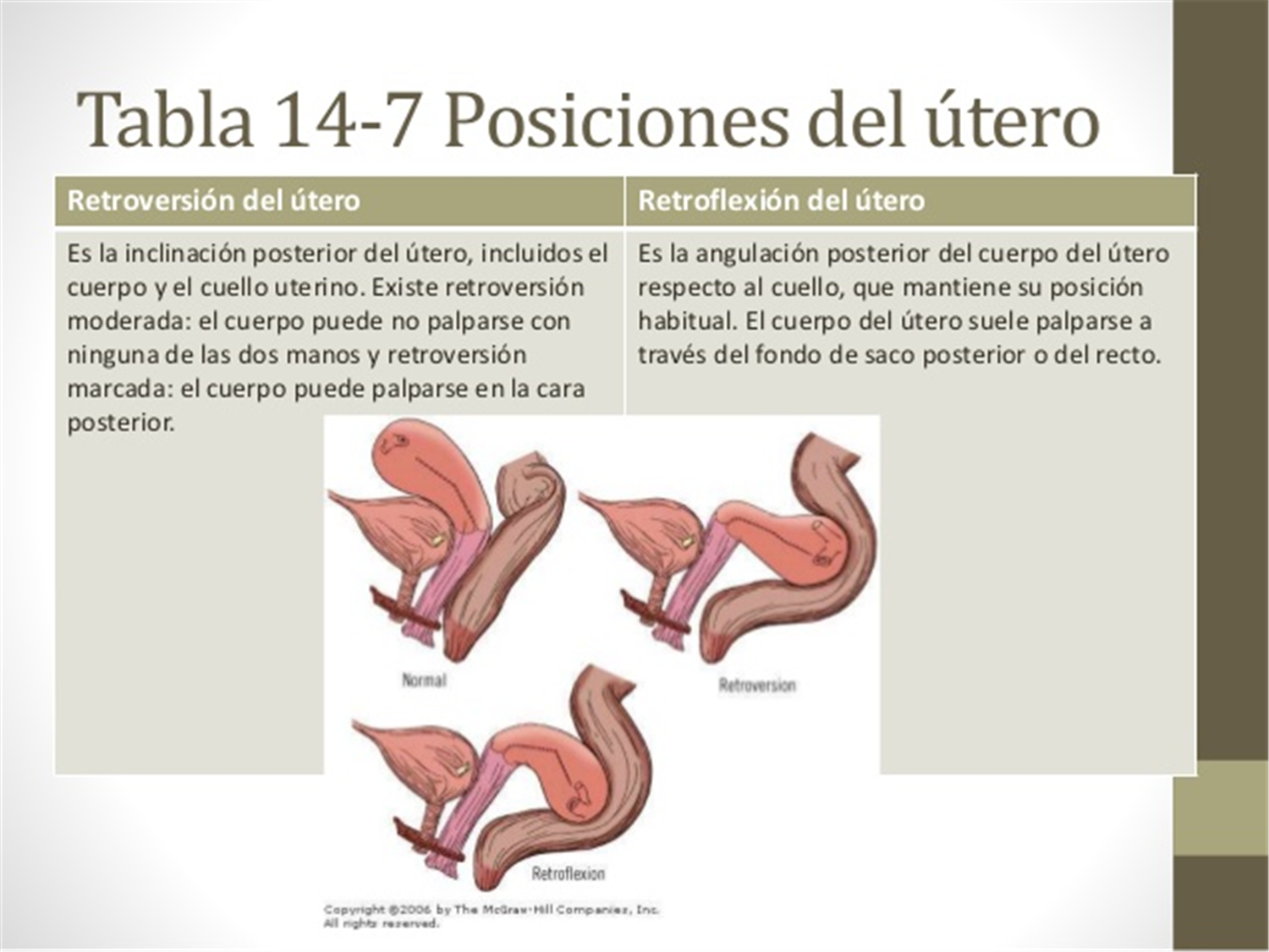 utero en retroversion dolor