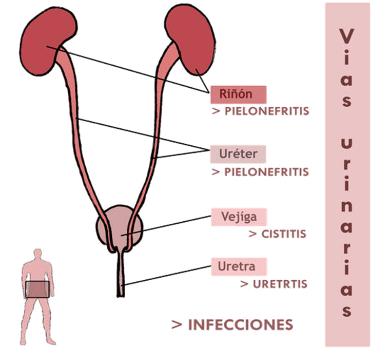 Infección De Vías Urinarias At Emaze Presentation