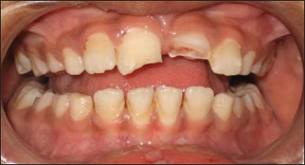 Dental and Oral Emergencies at emaze Presentation