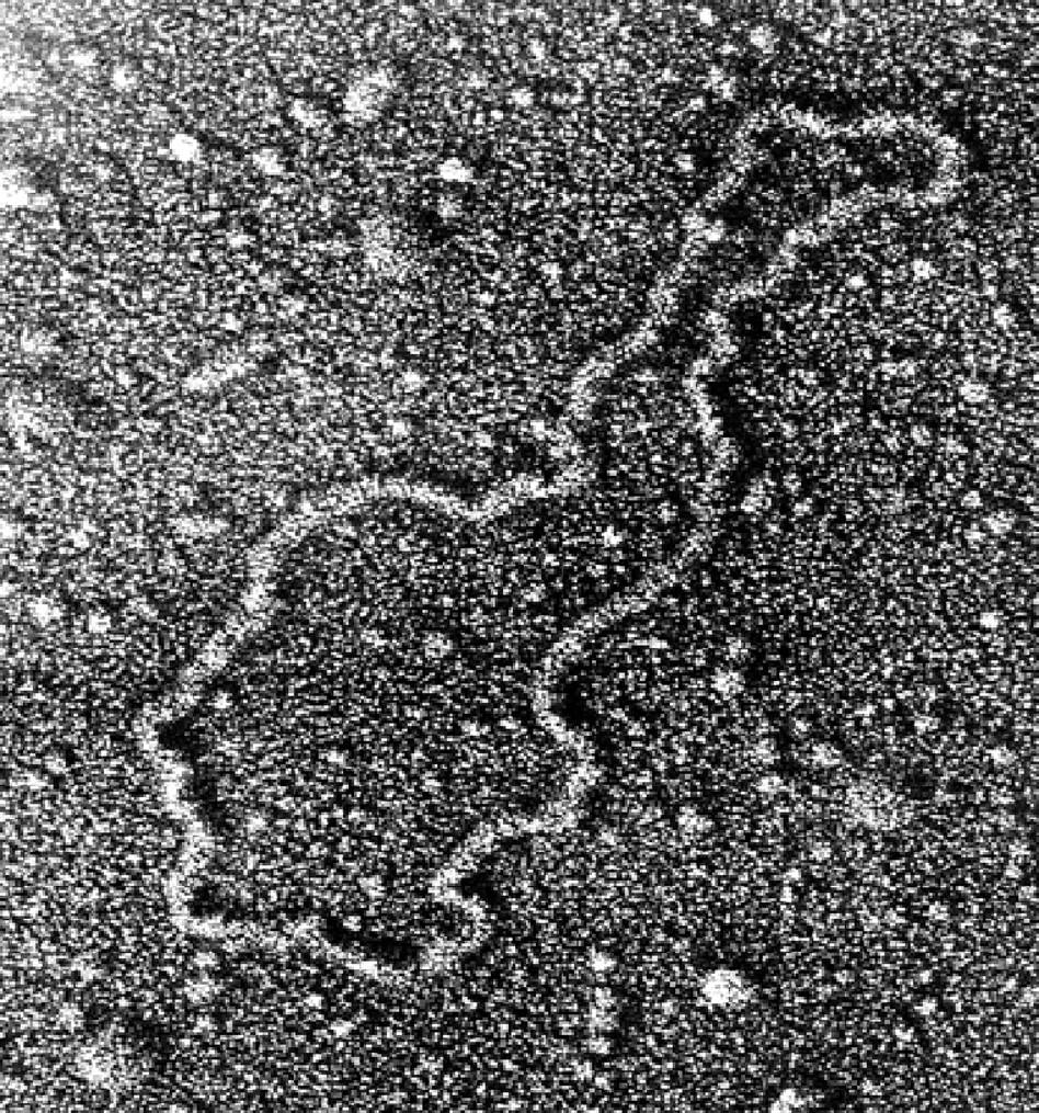 Клетка бактерии имеет днк. Плазмиды бактерий микроскоп. Микрофотография кольцевой ДНК. Хромосомы микрофотография. Микрофотография бактериальной клетки.