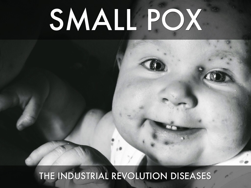 Smallpox Def Presentation Name at emaze Presentation