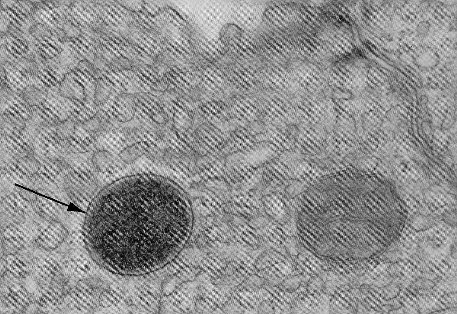 Какова функция органоида электронная микрофотография которого представлена на рисунке