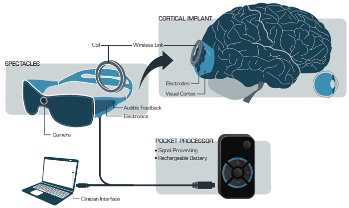 BIONIC EYE at emaze Presentation