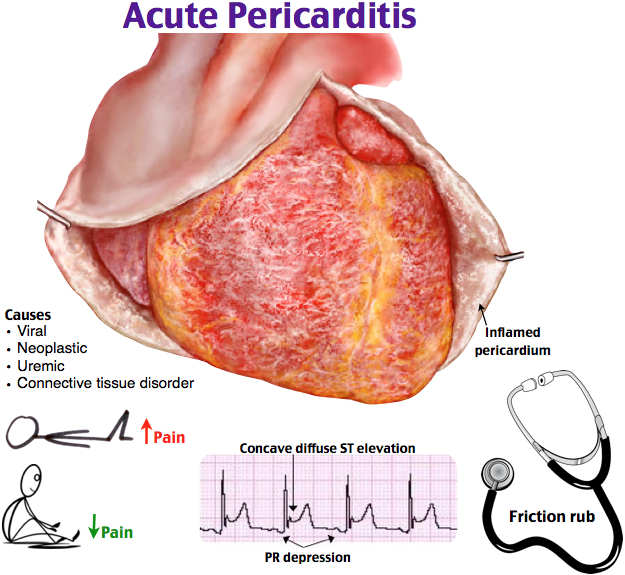 Cardiovascular continued on emaze