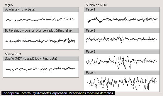 Resultado de imagen para MOR EEG