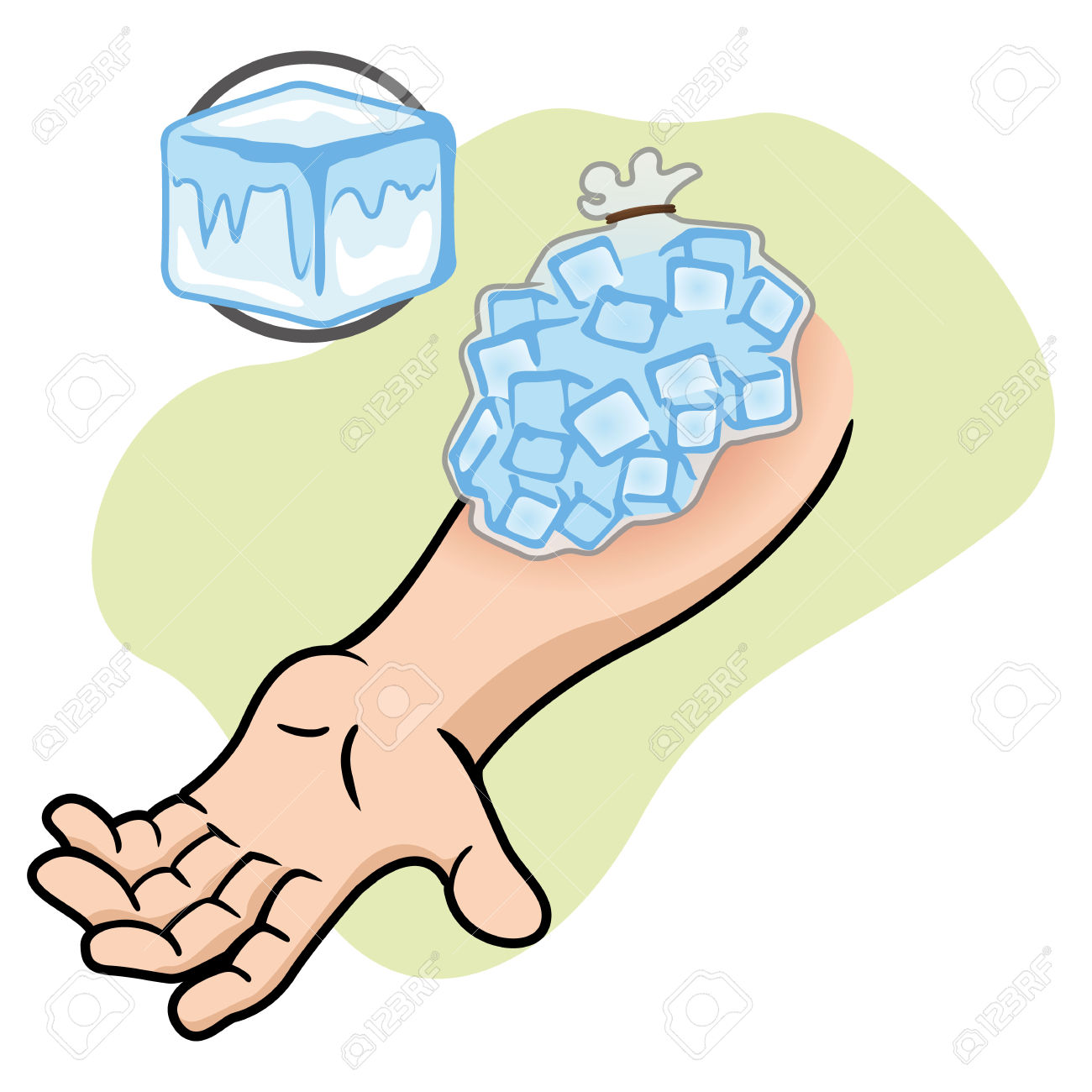 Пузырь со льдом на руке