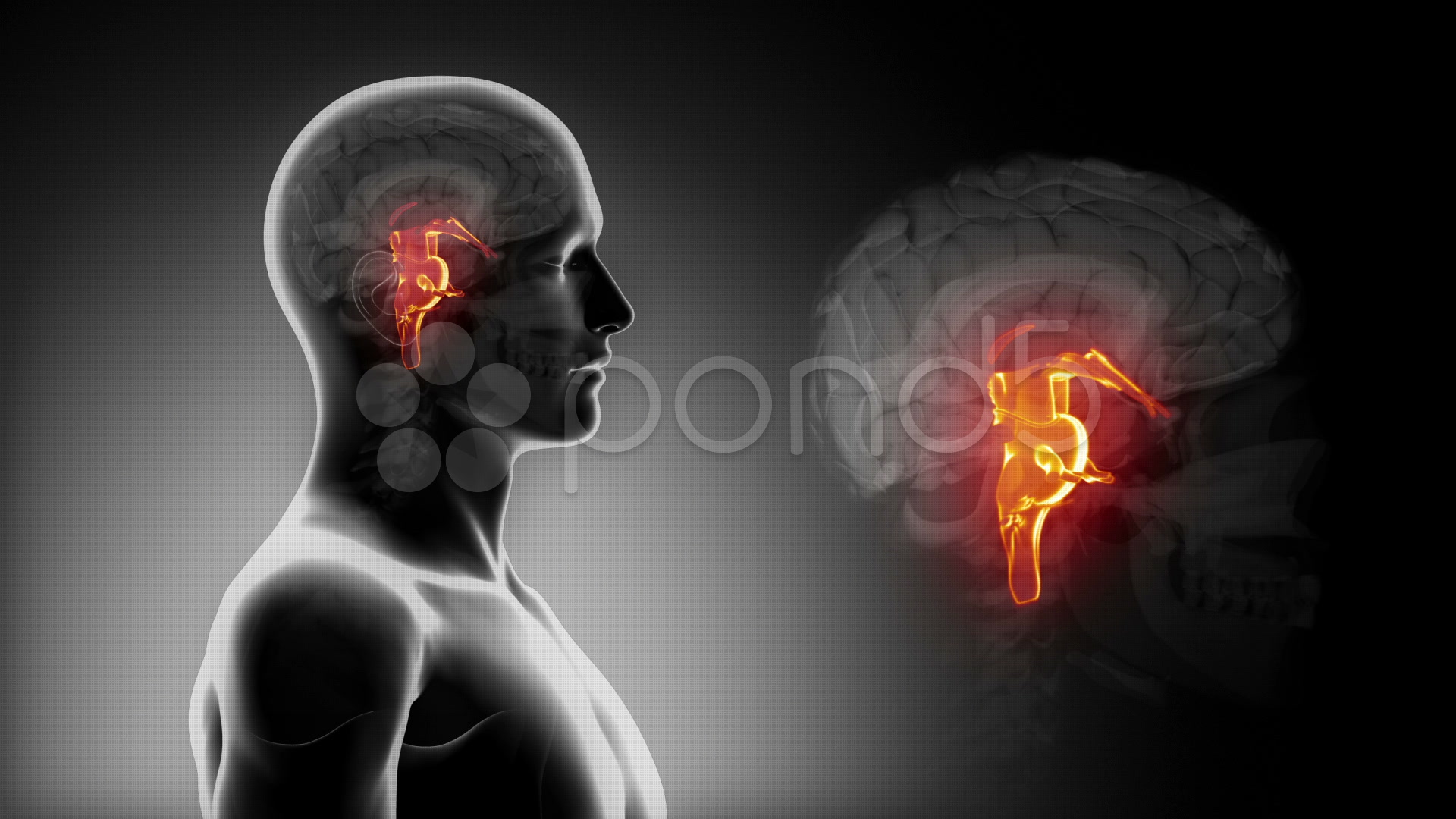 Resultado de imagen de NERVIO OLFATORIO 3D