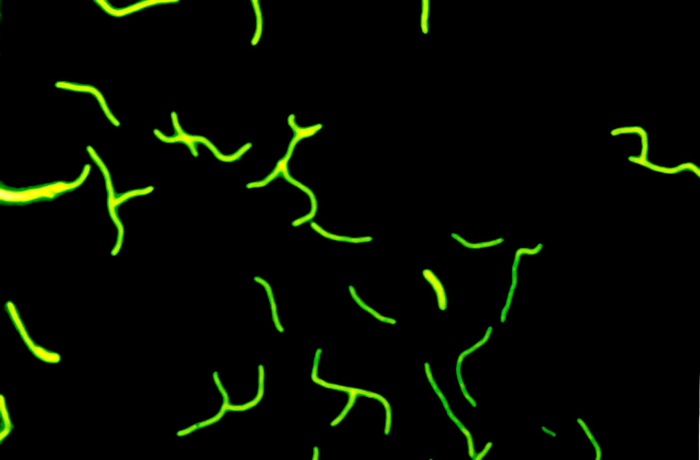 Метаногены. Methanobacterium thermoautotrophicum. Methanobacterium изображение. Methanobacterium отдел класс группа семейство.