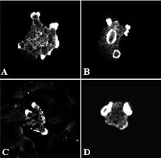 Naegleria Fowleri At Emaze Presentation