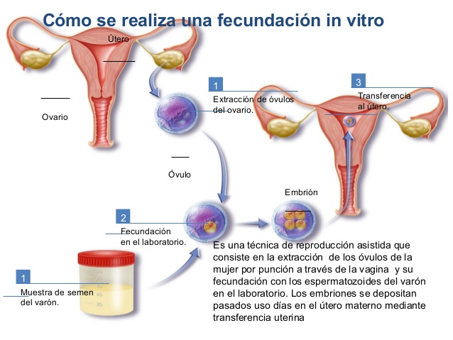 Filtración en que consiste