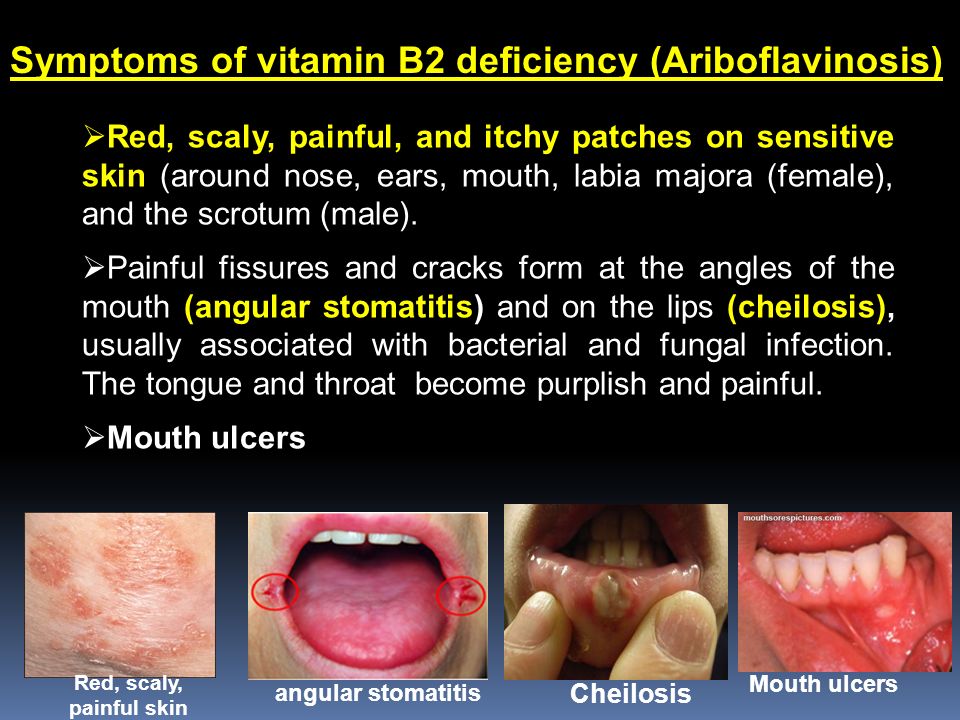 Vitamins at emaze Presentation