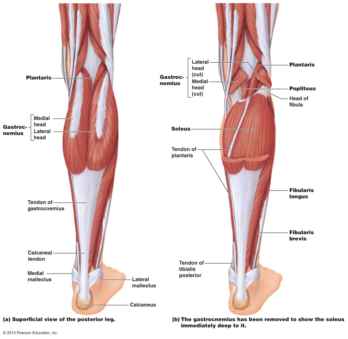 image-gallery-soleus-strain