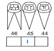 Resultado de imagen para odontograma tratamiento pulpar