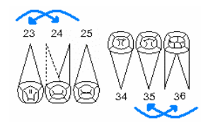 Resultado de imagen para protesis total odontograma