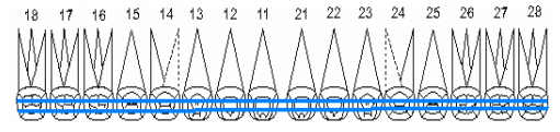 Resultado de imagen para protesis total odontograma