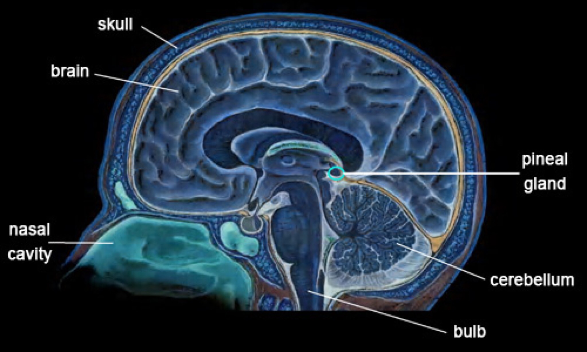 Длинные отростки головного мозга. Шишковидная железа головного мозга. Ретроцеребеллярная киста шишковидной железы. Киста шишковидной железы мрт. Шишковидное тело в головном мозге.