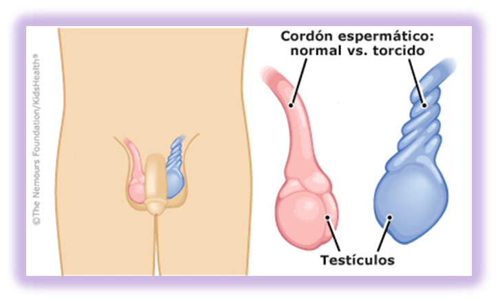 Porque se pueden inflamar los testiculos