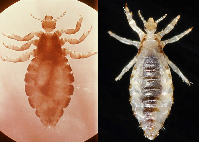 Lou's Insect The louse at emaze Presentation