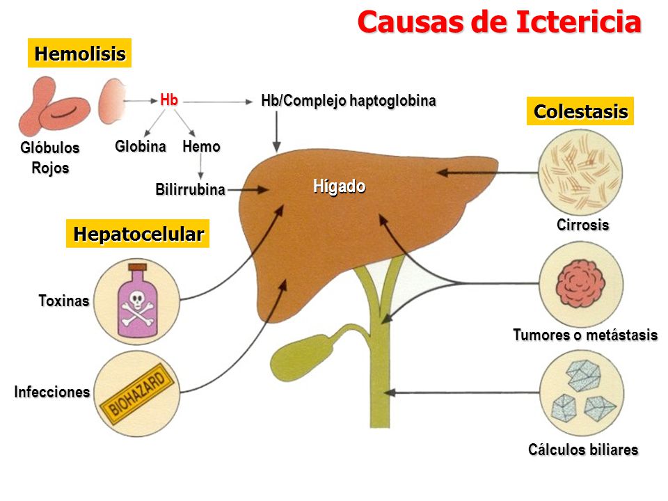 ICTERICIA on emaze