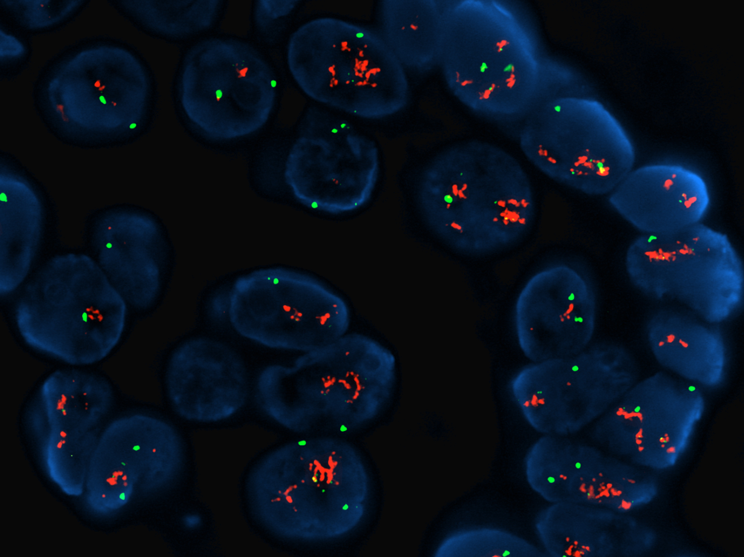 Fish method. Fish гибридизация in situ. Fluorescence in situ hybridization Fish. Флуоресцентная гибридизация in situ Fish. Флюоресценция гибридизация in situ.