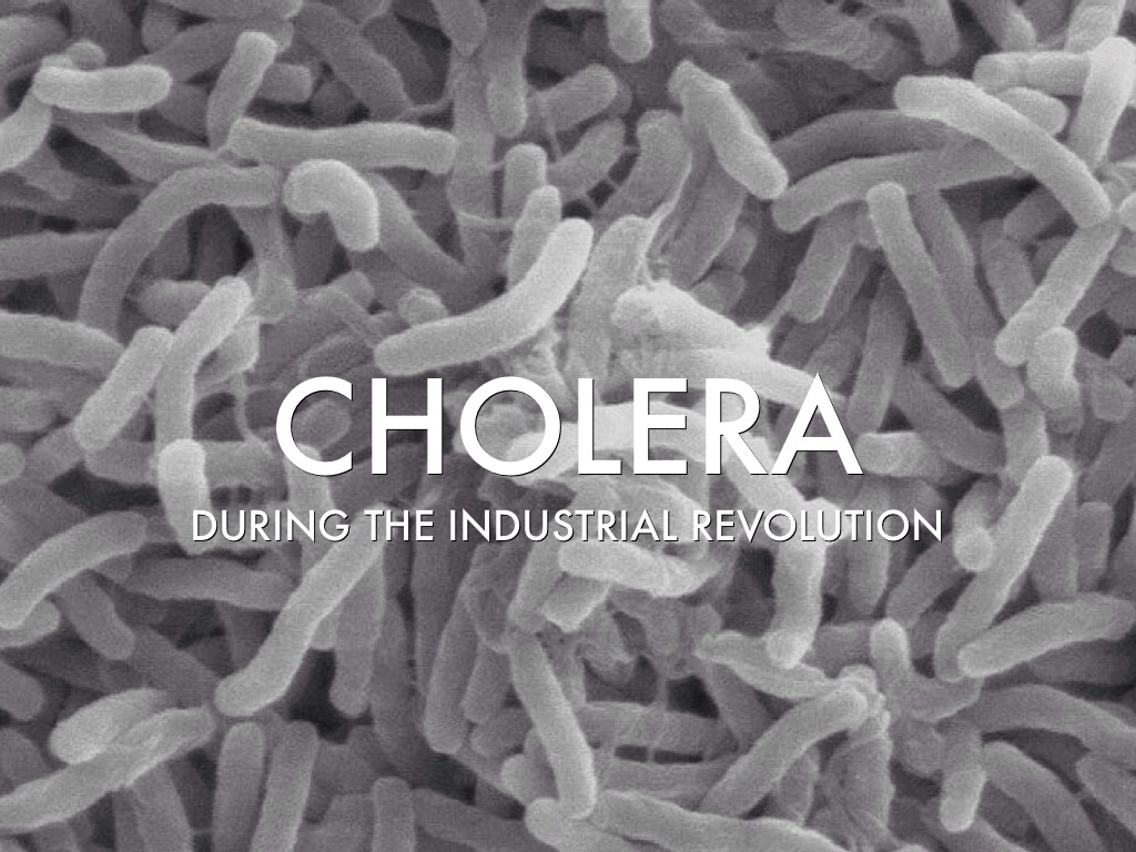 Какой возбудитель холеры. Холерный вибрион под электронным микроскопом. Холерный вибрион паразит. Вибрионы под микроскопом.