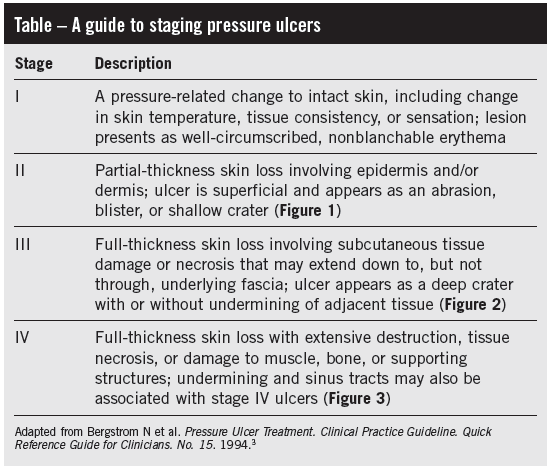 Staging Pressure Ulcers at emaze Presentation