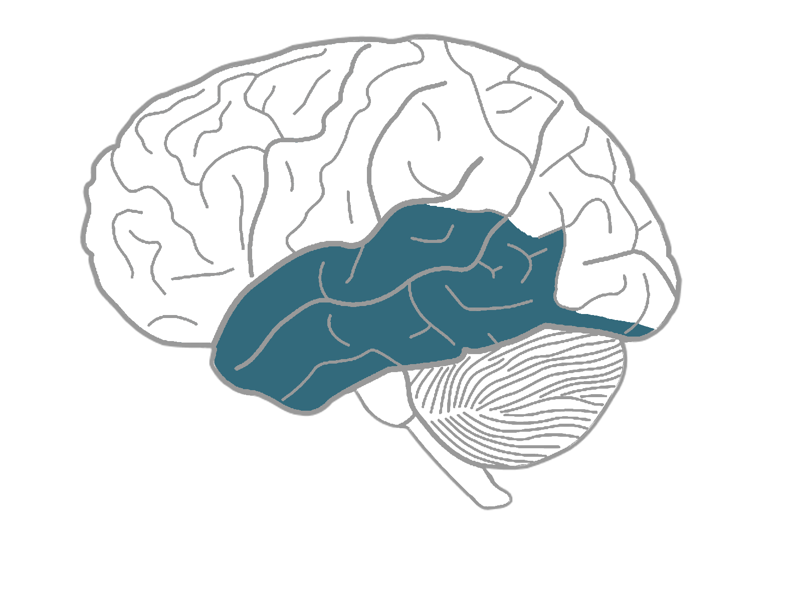 a picture of a temporal lobe