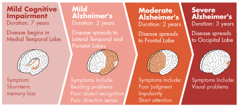 Cognitive impairment