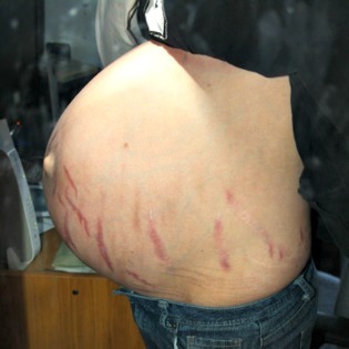como quemar grasa de la barriga rapido