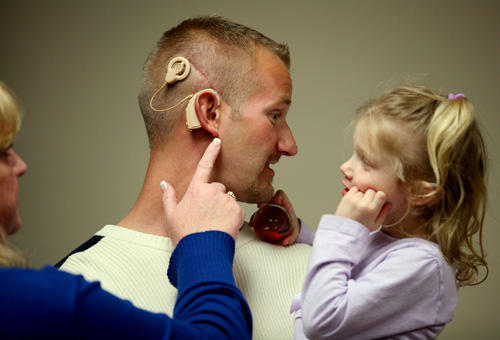 Who invented the bionic ear?