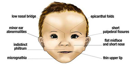 issues with pregnancy presentation on emaze