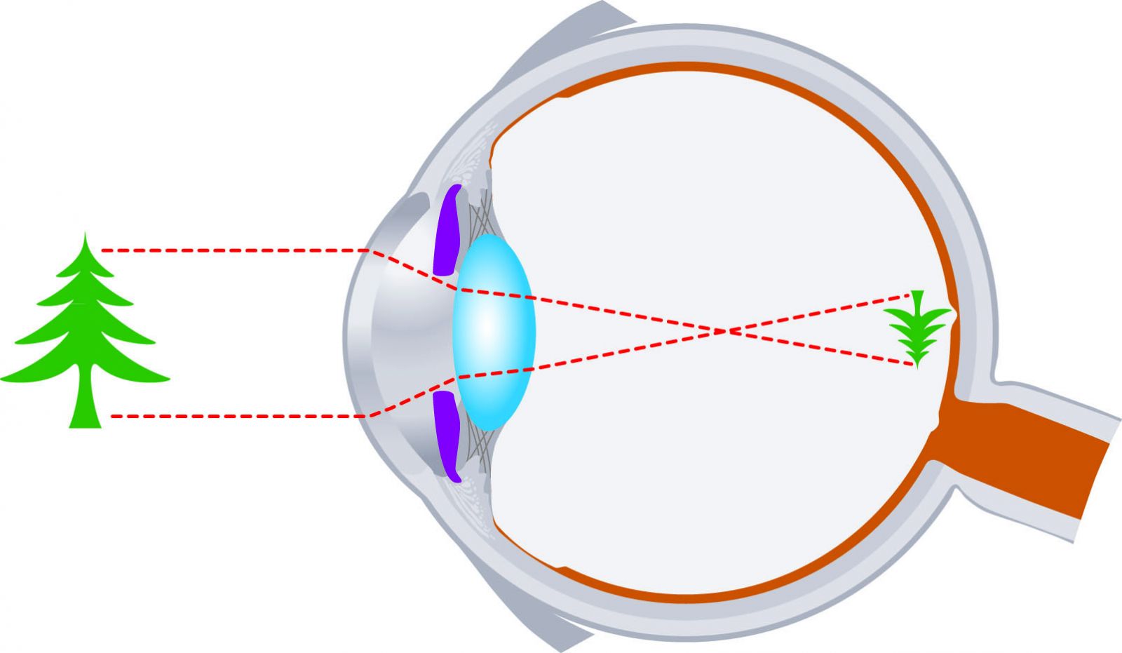 Проекция изображения на сетчатку глаза
