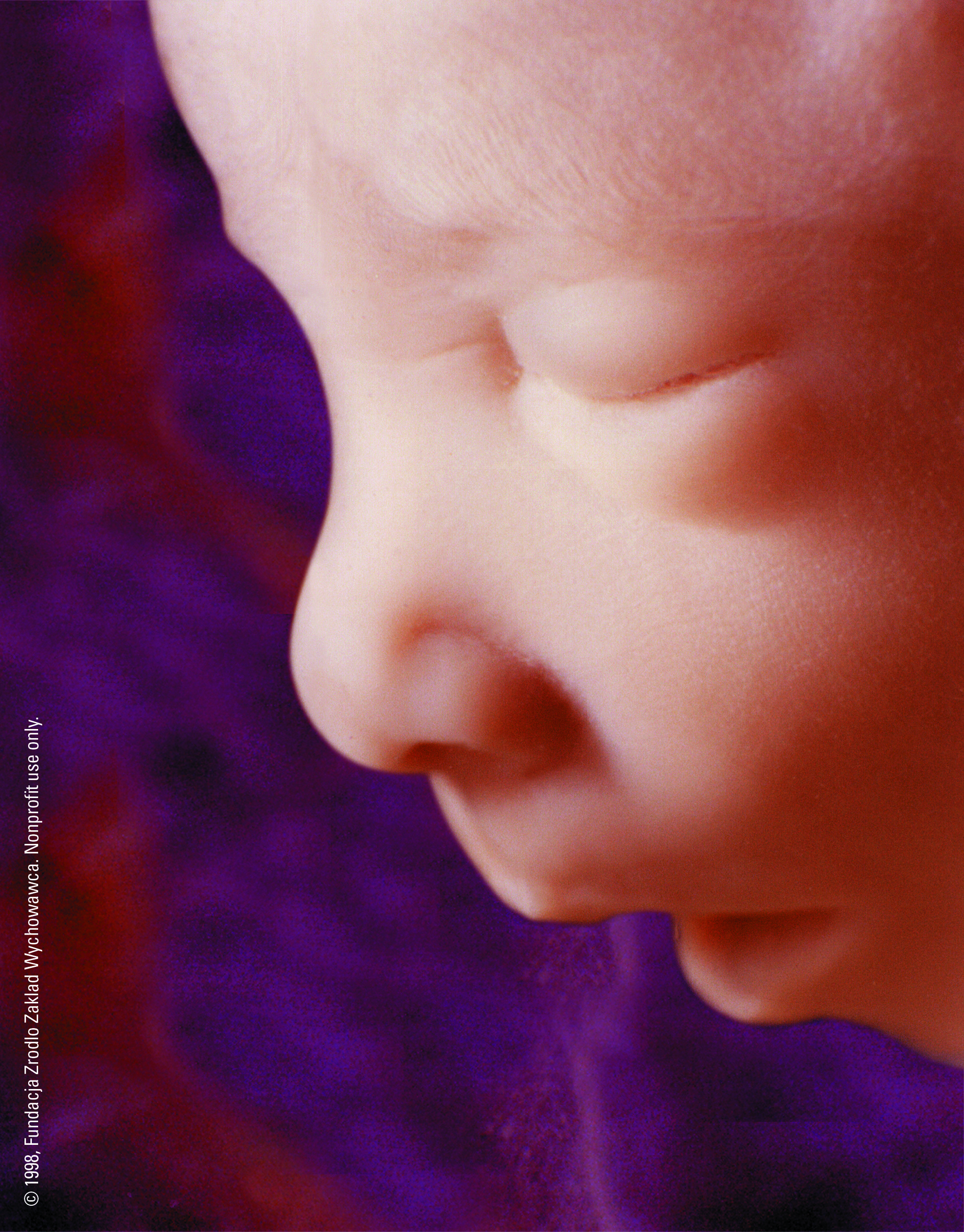 Крови 17 недель. 17 Недель беременности. Малыш на 17 неделе беременности. 17 Недель беременности фото ребенка. Лицо младенца.