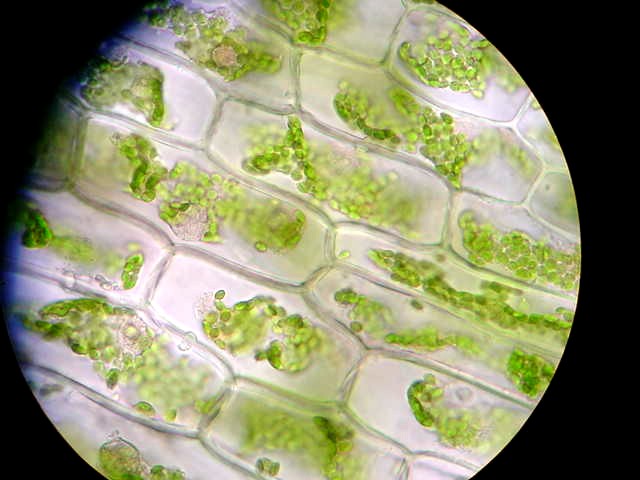 Хлоропласты в клетках листьев крупные. Хлоропласт в световой микроскоп. Клетка элодеи под микроскопом. Пластиды элодеи. Клетки элодеи в микроскопе.