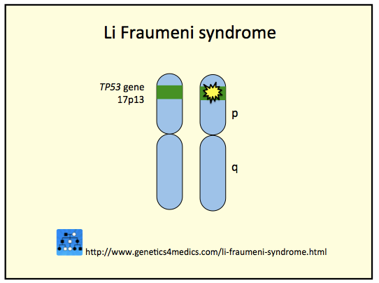 Синдром ли. Синдром ли-Фраумени. Синдром ли-Фраумени онкоген. Синдром ли Фраумени Онкосупрессор. Синдром ли-Фраумени фото.