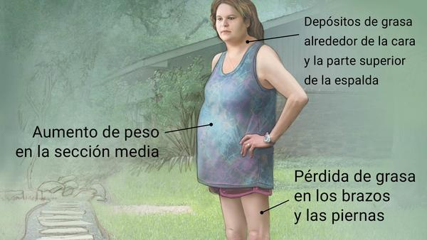 Resultado de imagen para sindrome de cushing sintomas