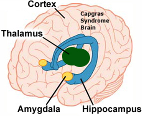 Capgras Syndrome at emaze Presentation