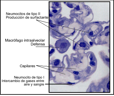 Resultado de imagen para neumocitos