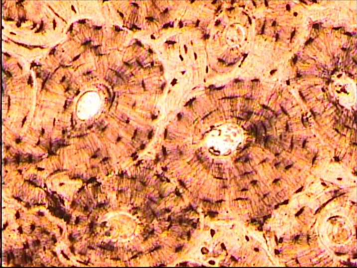 Срез кости. Костная ткань микрофотография. Костная ткань под микроскопом. Остеон микроскоп. Остеон под микроскопом.