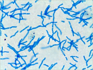 Помидор болгарская палочка. Болгарская палочка (Lactobacterium bulgaricum). Lactobacillus delbrueckii subsp. Bulgaricus под микроскопом. Лактобацилус Дельбрюк. Lactobacillus bulgaricus прд микроскоп.