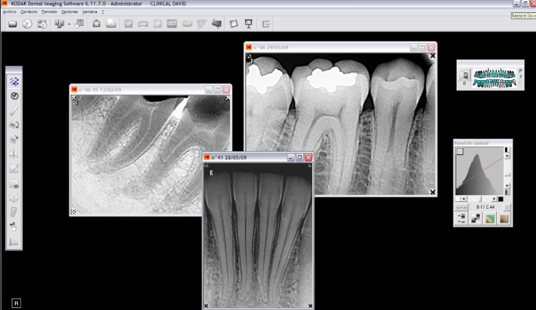 Cs imaging. Kodak Dental Imaging software 6.7.11. Kodak Dental Imaging software 6.12.30.0. Dental Imaging software 6.14.7 Dicom. CS Imaging Dental.