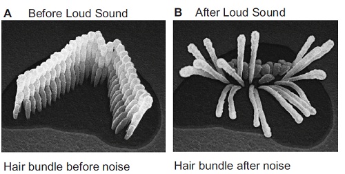 damaged ear