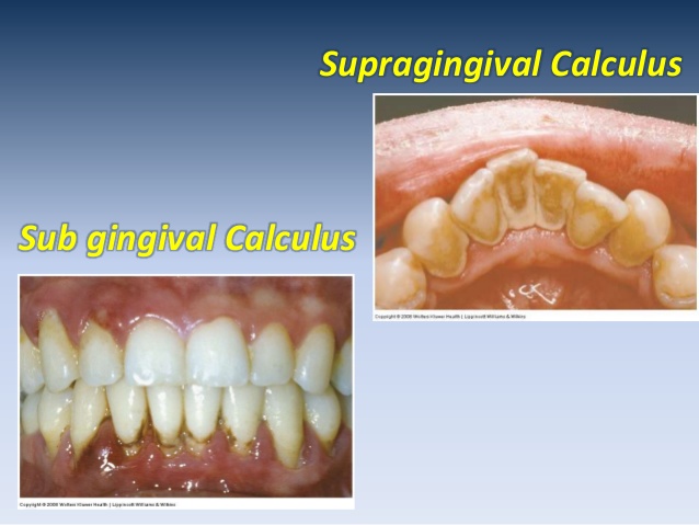 Microbiologia Periodontal On Emaze