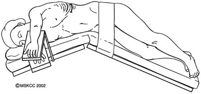 Simple Flank Incision abdomenal incision at emaze Presentation